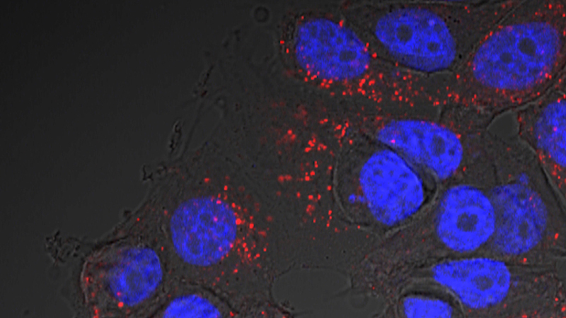 Extracellular vesicles under microscope