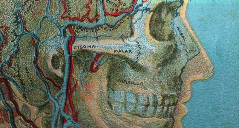 A medical illustration of a face, showing bone structure and blood vessels