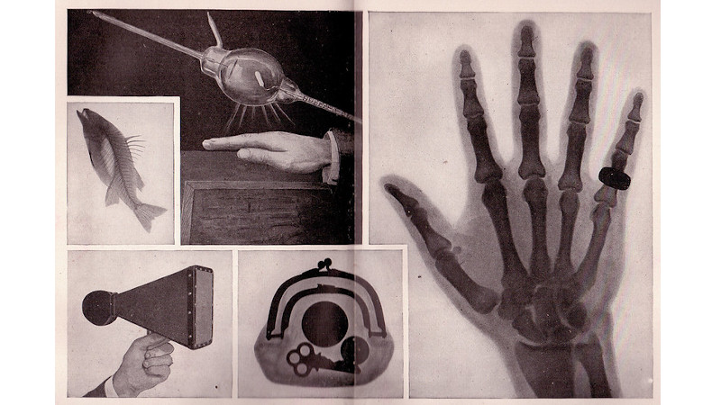 Discovery of x-ray